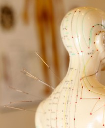 Akupunktur an einer Puppe mit Akupunkturlinien